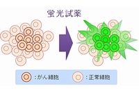 研究グループが開発した蛍光試薬を用いたがんの検出のイメージ。β－ガラクトシダーゼの活性が促進されているがん細胞で蛍光が観察され、がんの容易な識別が可能となる（東京大学などの発表資料より）