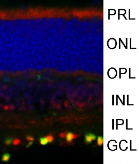 網膜内でのWNT7Bの発現。WNT7Bは網膜の神経節細胞に発現しており、マウス実験近視モデルではこの発現が有意に亢進していた（京都大学の発表資料より）