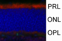 網膜内でのWNT7Bの発現。WNT7Bは網膜の神経節細胞に発現しており、マウス実験近視モデルではこの発現が有意に亢進していた（京都大学の発表資料より）