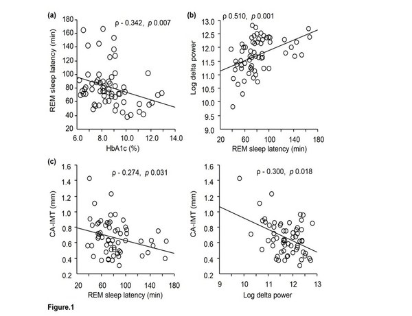 睡眠指標(レム睡眠潜時、ログデルタパワー)とHbA1c・頸動脈内膜中膜肥厚度との相関を示す図。血糖コントロール指標「HbA1c」は、睡眠時無呼吸症候群の指標である無呼吸・低呼吸インデックス(AHI)と独立してREM睡眠潜時と有意の負の関連を示した。これは、血糖コントロール増悪を示すHbA1cの上昇が、深睡眠指標であるレム睡眠潜時の短縮をもたらすことを示唆する結果だった。（大阪市立大の発表資料より）