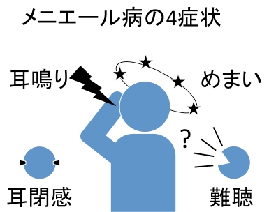 メニエール病の4つの症状を示す図。（東北大学の発表資料より）