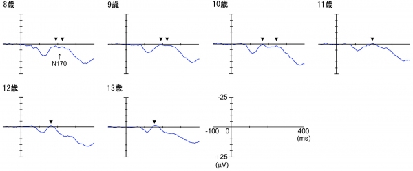 正立した顔に対する脳波成分（N170）は、8～11歳では、幅広い形で、少なくとも2つのピークを持つ波形であったが、12、13歳では、1つのピークを持つ明瞭な波形だった。（生理学研究所の発表資料より）