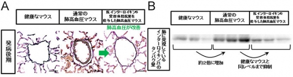 低酸素誘発性肺高血圧症（HPH）マウスに対する抗インターロイキン6（IL-6）受容体抗体の効果を示す図。A. 低酸素負荷でコントロール抗体投与下でのHPHマウスでは肺動脈壁の肥厚が観察されたのに対して、抗IL-6受容体抗体を投与したマウスでは肺動脈壁の肥厚が抑制されていた。B. 低酸素負荷でコントロール抗体投与下ではHPHマウス肺においてIL-21の発現が誘導されたが、抗IL-6受容体抗体を投与したマウス肺では発現誘導が抑制されていた。（大阪大学の発表資料より）