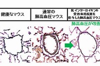 低酸素誘発性肺高血圧症（HPH）マウスに対する抗インターロイキン6（IL-6）受容体抗体の効果を示す図。A. 低酸素負荷でコントロール抗体投与下でのHPHマウスでは肺動脈壁の肥厚が観察されたのに対して、抗IL-6受容体抗体を投与したマウスでは肺動脈壁の肥厚が抑制されていた。B. 低酸素負荷でコントロール抗体投与下ではHPHマウス肺においてIL-21の発現が誘導されたが、抗IL-6受容体抗体を投与したマウス肺では発現誘導が抑制されていた。（大阪大学の発表資料より）