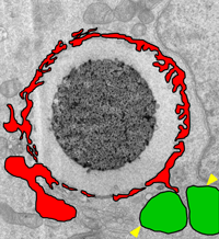 細胞内に入ったDNAビーズの電子顕微鏡写真。赤は核膜に似た膜。緑はオートファジー関連の膜（情報通信研究機構の発表資料より）