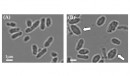 バイオプラスチックを蓄積している野生型大腸菌（A）と「風船型」大腸菌（B）の顕微鏡写真。矢印で示したように風船のように膨らんだ細胞が観察される。（北海道大学の発表資料より）