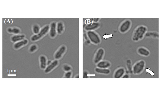 バイオプラスチックを蓄積している野生型大腸菌（A）と「風船型」大腸菌（B）の顕微鏡写真。矢印で示したように風船のように膨らんだ細胞が観察される。（北海道大学の発表資料より）