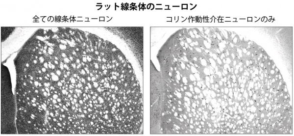 左の画像は、ラットの脳内で線条体と呼ばれる高度な意思決定を司る部位にある全てのニューロン（黒色の点）。右の画像は、コリン作動性介在ニューロンのみ。コリン作動性介在ニューロンは線条体のニューロンのうちわずか1～2％しか存在しない神経細胞で、行動の柔軟性に関わっている。（大きな白い点は神経線維の束）（写真提供：OIST）