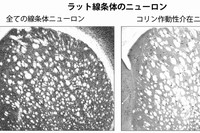 左の画像は、ラットの脳内で線条体と呼ばれる高度な意思決定を司る部位にある全てのニューロン（黒色の点）。右の画像は、コリン作動性介在ニューロンのみ。コリン作動性介在ニューロンは線条体のニューロンのうちわずか1～2％しか存在しない神経細胞で、行動の柔軟性に関わっている。（大きな白い点は神経線維の束）（写真提供：OIST）