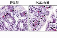 PGD2はマスト細胞数の増加を抑えてアレルギー症状を抑制する。食物アレルギーモデルマウスは便が軟らかくなる症状を示す。PGD2を作れないマウスでは軟便を示すマウスが多くなり（左）、腸管のマスト細胞数（黒矢印、赤色の細胞）が増えていた（右）。（東京大学の発表資料より）