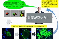 東京医科歯科大学の岡澤均教授の研究グループは、アルツハイマー病態に飢餓状態が重なると、症状が悪化する可能性があることを示した。（写真：東京医科歯科大学の発表資料より）