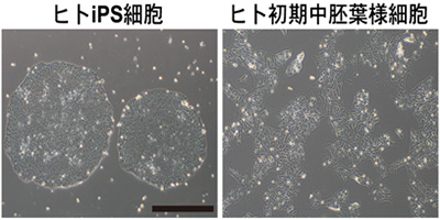 ヒトiPS細胞とそれから誘導したヒト初期中胚葉様細胞の位相差顕微鏡写真（スケールバー 200μm、京都大学の発表資料より）