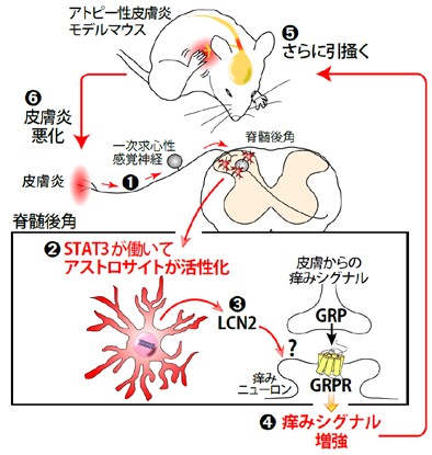 今回の研究で明らかになった、アトピー性皮膚炎の慢性的な痒みが生じるメカニズムの概要を示す図。（九州大学の発表資料より）