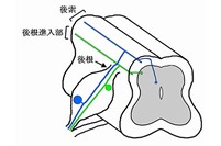 切断した脊髄の模式図で、図の上が背側で下が腹側。後根を通る痛覚神経突起（緑色）と固有感覚神経突起（青色）は、脊髄へ入ると分別される。痛覚神経突起は脊髄の外側部（後根進入部）を長軸方向に走行し、固有感覚神経突起は背側部（後索）を長軸方向に走行する。（理化学研究所の発表資料より）