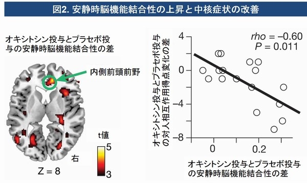 内側前頭前野と呼ばれる脳の領域の機能（安静時機能的結合）の改善が強い参加者ほど中核症状の改善効果も強く認められた。（東京大学の発表資料より）