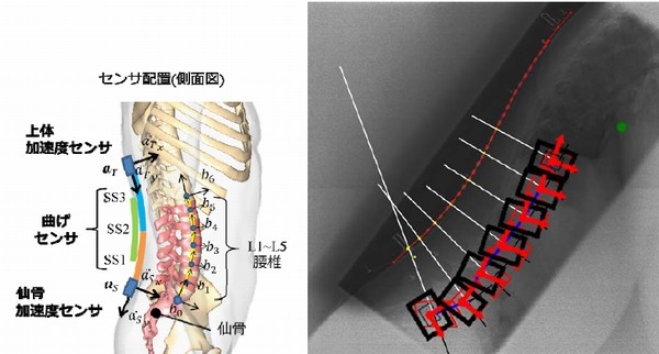 センサ構成（左）を示す図と、レントゲン撮影結果（右・赤）、推定結果（右・黒）。背面に配置したセンサ群によって非侵襲でレントゲン撮影と同等の腰椎形状の推定ができる。（北海道大学の発表資料より）