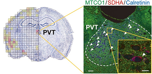 モデルマウスのうつ状態の原因脳部位を示す図。異常なミトコンドリアDNAが視床室傍核(PVT)に著しく蓄積し(左の図の赤い部分)、この部位にはミトコンドリア機能障害を持つ細胞（黄色枠内の赤く見える細胞）が多く見られた。（理化学研究所の発表資料より）