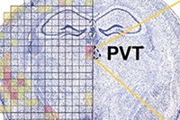 モデルマウスのうつ状態の原因脳部位を示す図。異常なミトコンドリアDNAが視床室傍核(PVT)に著しく蓄積し(左の図の赤い部分)、この部位にはミトコンドリア機能障害を持つ細胞（黄色枠内の赤く見える細胞）が多く見られた。（理化学研究所の発表資料より）