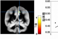 右楔前部と主観的幸福の間に示された正の関係。左図は脳の領域を指す。右図は体積と主観的幸福の関係を示す散布図（京大の発表資料より）