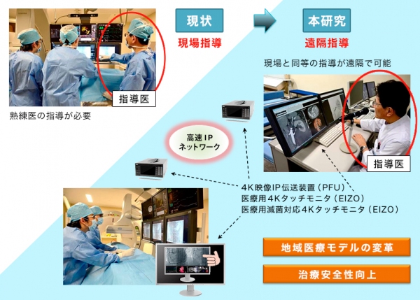 血管内治療の現状と新システムへ移行のイメージ（EIZO発表資料より）