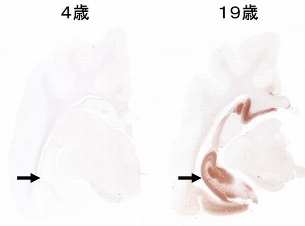 高齢のネコでは海馬（矢印）に高リン酸化タウが蓄積する。若齢のネコの脳では高リン酸化タウは検出されない。（東京大学の発表資料より）