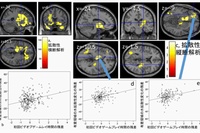 初回参加時におけるビデオゲームプレイ時間と脳の拡散性の正相関（a,b）と数年後の脳の拡散性の変化の正相関（c,d,e）を示す図。（東北大学の発表資料より）