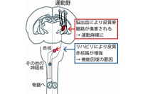 今回の研究では、脳出血後の集中的なリハビリは運動野－赤核間の軸索の投射を増加させ、それによって運動機能の回復を導くことが分かった。（生理学研究所の発表資料より）