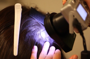 頭皮環境改善の臨床試験（シャープ発表資料より）