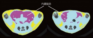 左が普通に高カロリー食を与えたマウス、右はそれに加えフコースを与えたマウスの内臓脂肪（紫色の部分）。顕著な違いが分かる。（画像：東京大学発表資料より）