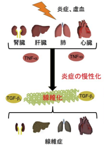 臓器の慢性的な炎症は、繊維化へと至る。（画像：東北大・広島大発表資料より）