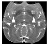 移植後のサルのMRI画像（矢印が細胞移植部分を示す）（写真: 京都大学 iPS細胞研究所の発表資料より）