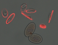 Newtic1を発現する赤血球。Newtic1タンパク質は成熟過程にある赤血球の縁にリング状に局在する。下に見える2つの赤血球は成熟しておりNewtic1を発現していない。（画像:筑波大学発表資料より）