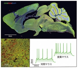 Ant1変異マウスの脳切片の染色像とセロトニン神経細胞の活動。（画像:理化学研究所発表資料より）
