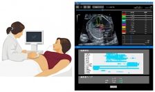 AIを用いた胎児心臓超音波スクリーニングのイメージ。(画像: 理化学研究所)