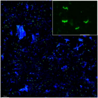 タカサゴシロアリの腸内でキシラナーゼを生産する共生細菌（緑）の分布の様子。青い大きな塊は木片の自家蛍光。右上の差込み画像は、共生細菌の拡大蛍光顕微鏡画像。スケールバーは 10μm。（撮影:松浦優氏）