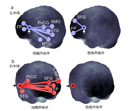 母親声条件と他者声条件における左下前頭回（a 白矢印）、右上側頭回（b 黒矢印）との脳機能結合。（画像:慶應義塾大学発表資料より）