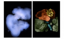 約60日間培養し形成されたミニ多臓器（左）と実体顕微鏡による観察像（右）（写真：東京医科歯科大学の発表資料より）