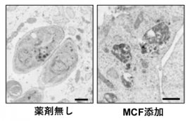 トキソプラズマの電子顕微鏡像。MCFの添加により原虫の死滅が確認された。（画像:帯広畜産大学発表資料より）