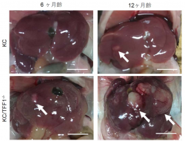 図１ KC マウスに発生した肝細胞癌。KC マウスでは 1年で小さな肝細胞癌が発生するが、 KC/TFF1KO マウスでは肝細胞癌は 6カ月で発生し、1年で巨大に発育した。（矢印：肝細胞癌） （画像: 名古屋大学の発表資料より）