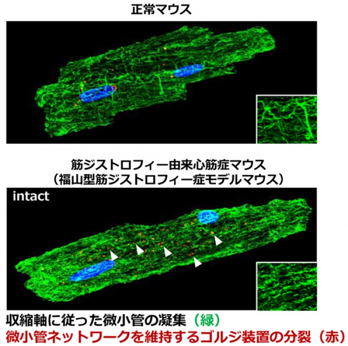 筋ジストロフィー心筋症でみられる収縮軸に沿った微小管の過重合（画像: 神戸大学資料より）