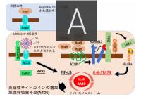 新型コロナウイルス感染後に重篤化するメカニズム（写真：北海道大学の発表資料より）