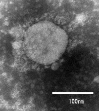 電子顕微鏡観察により確認されたウイルス粒子（画像:国立感染症研究所報道発表資料より）