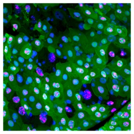 エレボーシス（暗黒の細胞死）を起こしているのは、緑や赤の蛍光タンパク質がなくなった黒い細胞（画像: 理化学研究所報道発表資料より）
