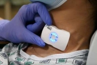 デンカが出資したカナダの医療機器新興Flosonics Medicalが開発しているパッチ型のワイヤレス・ウェアラブル超音波デバイス「FloPatch」。患者の首に貼り付けて血流をリアルタイムに測定できる。（写真：デンカの発表資料より）