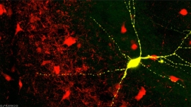 Shown in yellow, a parvalbumin interneuron in hippocampal (Sahay lab./Massgeneralbrigham.org) Shown in yellow, a parvalbumin interneuron in hippocampal (Sahay lab./Massgeneralbrigham.org)