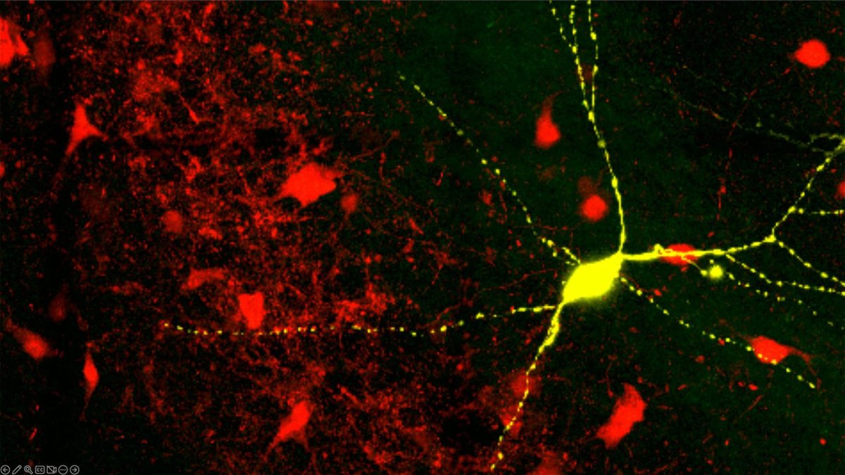 Shown in yellow, a parvalbumin interneuron in hippocampal (Sahay lab./Massgeneralbrigham.org)