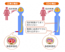 ED治療の現状