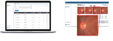 「眼底画像診断支援システム OPTiM Doctor Eye」医療機器プログラムの認証を取得