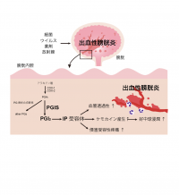 昭和大学らの共同研究グループが出血性膀胱炎の新たな発症機構を解明