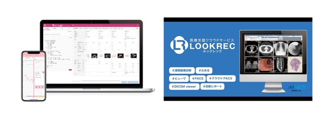 産婦人科向け電子カルテ『CLIPLA Luna』と株式会社エムネスの『LOOKREC』が連携を開始